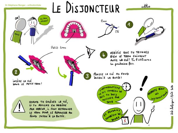 Orthodontie - Tuto